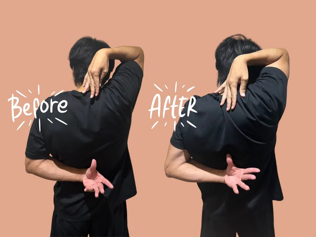 横浜店 肩甲骨ストレッチのビフォーアフター